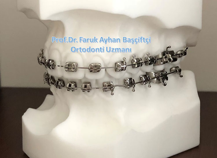 Prof. Dr. Faruk Ayhan BAŞÇİFTÇİ Ortodonti Kliniği