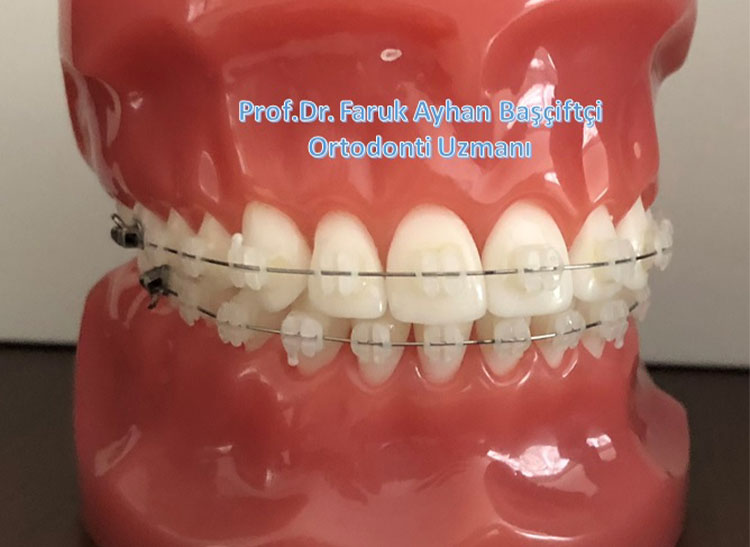 Prof. Dr. Faruk Ayhan BAŞÇİFTÇİ Ortodonti Kliniği