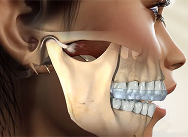 Temporomandibular Eklem